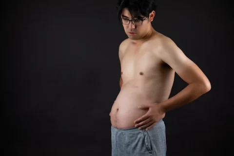 ไขมันในช่องท้อง Visceral Fat สัมพันธ์กับ TOFI Thin Outside Fat Inside ภาวะผอมแต่มีพุงอย่างไร